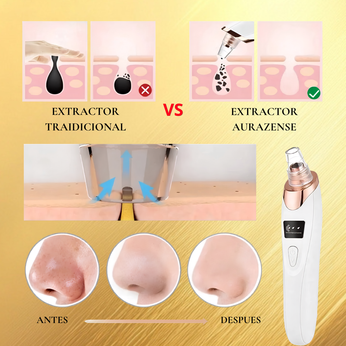 Limpiador facial extractor de imperfecciones