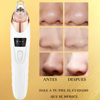 Limpiador facial extractor de imperfecciones